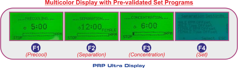 PRP-Ultra-Display